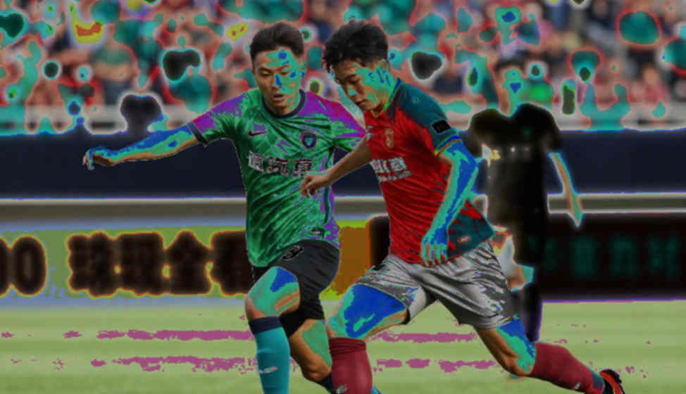 Mbappé's Knee: Capsule Hyperextension, Two Clocks, and Who Actually Controls the Return Date
